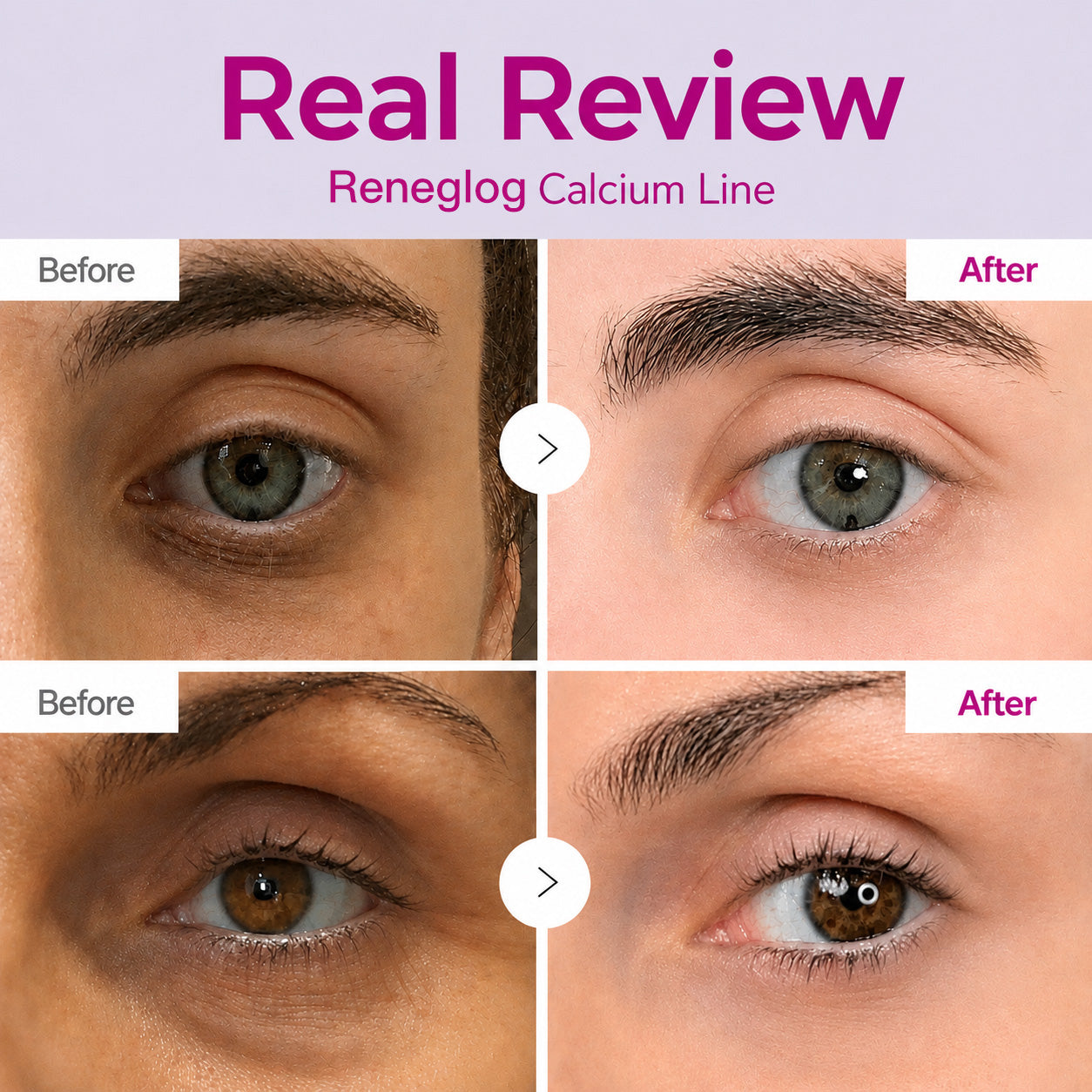 🔥LAST DAY 50% OFF!!Avlunexa Korean Calcium Dark Spot Eye Cream