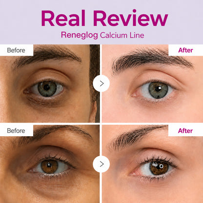 🔥LAST DAY 50% OFF!!Avlunexa Korean Calcium Dark Spot Eye Cream